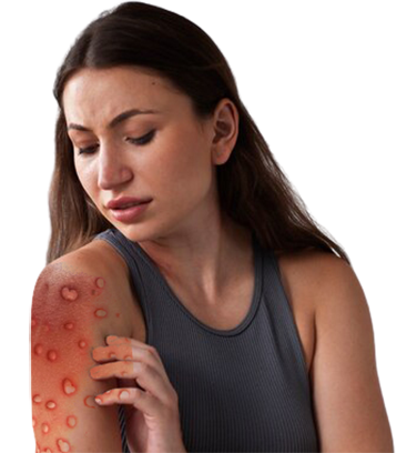 Ayurvedic Treatment for Bullous Disease - Types, Causes, Symptoms and More