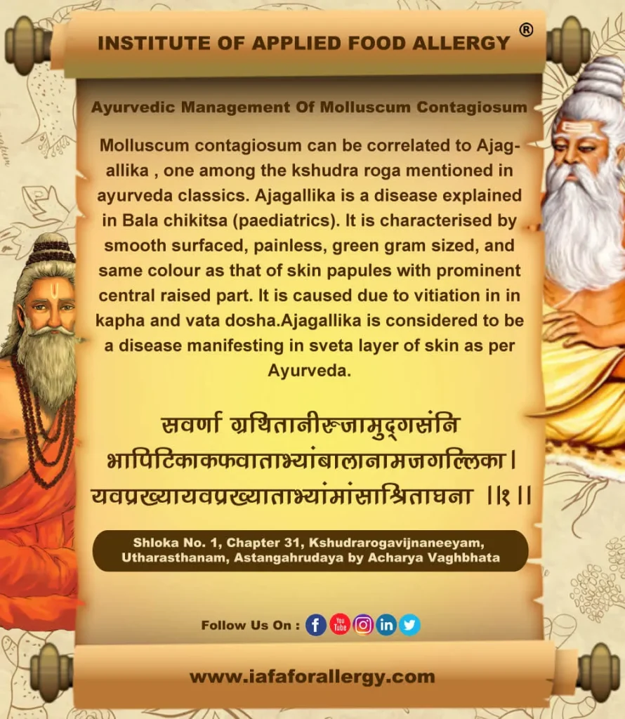 Ayurvedic Management of Molluscum Contagiosum