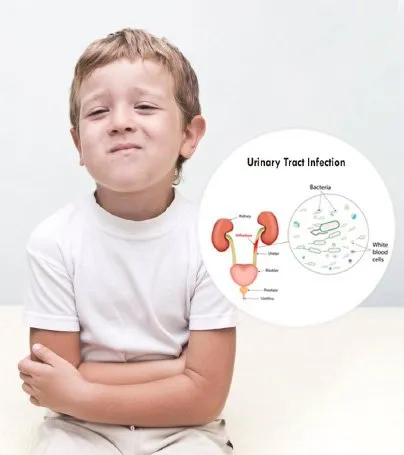 Urinary Tract Infection in Children