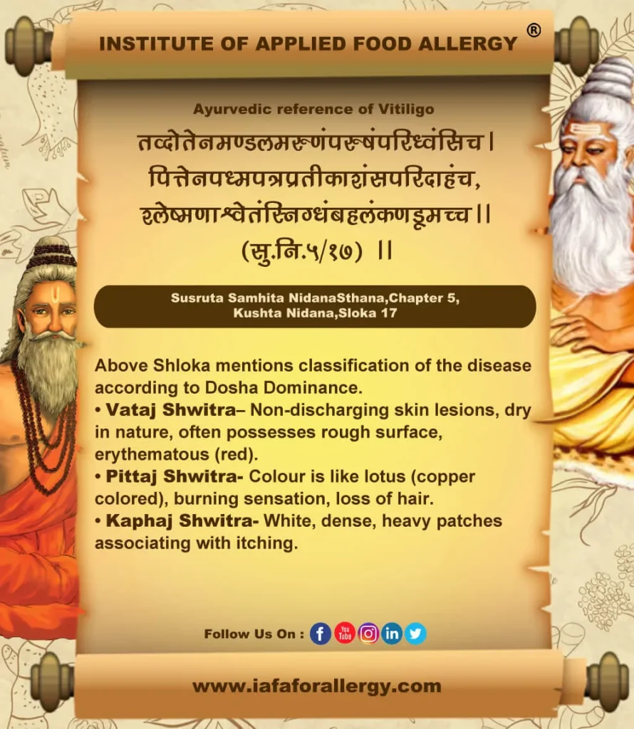 Ayurvedic Reference of Vitiligo (Shwitra Kushta)