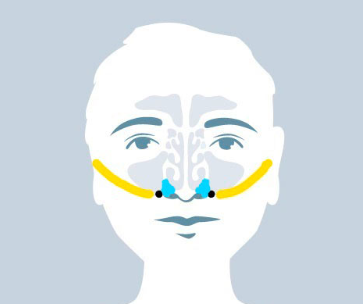 Nasal Bone Pressure Point Nasal Bone Pressure Point