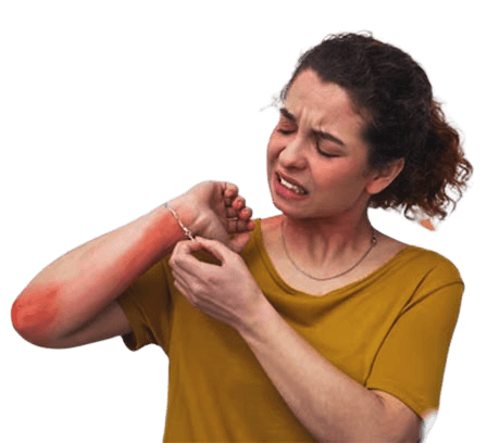 Nickel Allergy - Causes, Symptoms and Treatment