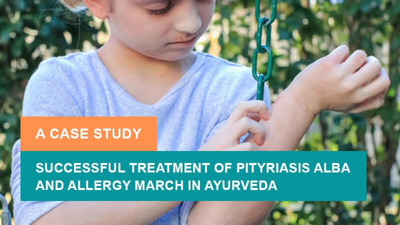 Successful Treatment of Pityriasis Alba and Allergy March in Ayurveda - A Case Study