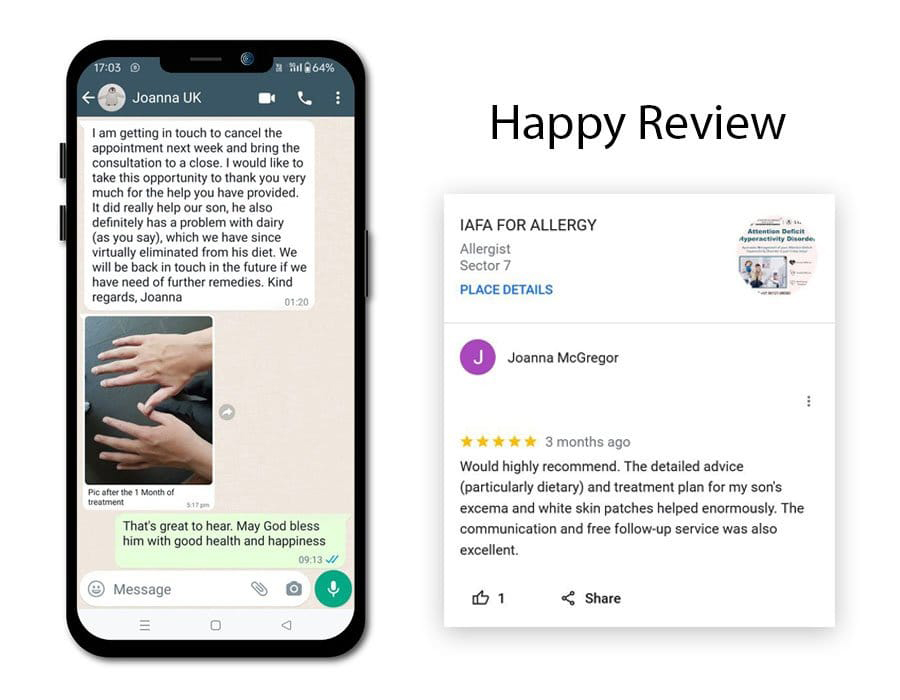 12-Year-Old Child from United Kingdom (UK) Recovered from Pityriasis Alba and Allergic March - A Case Study