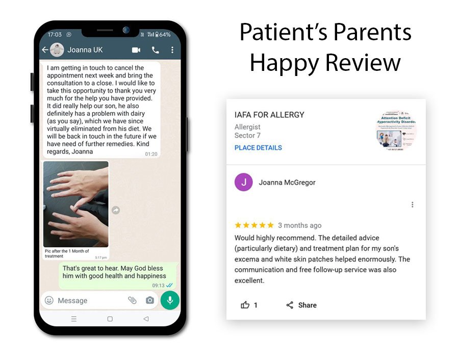 Patient’s Parents Happy Review - Successful Treatment of Pityriasis Alba and Allergy March in Ayurveda