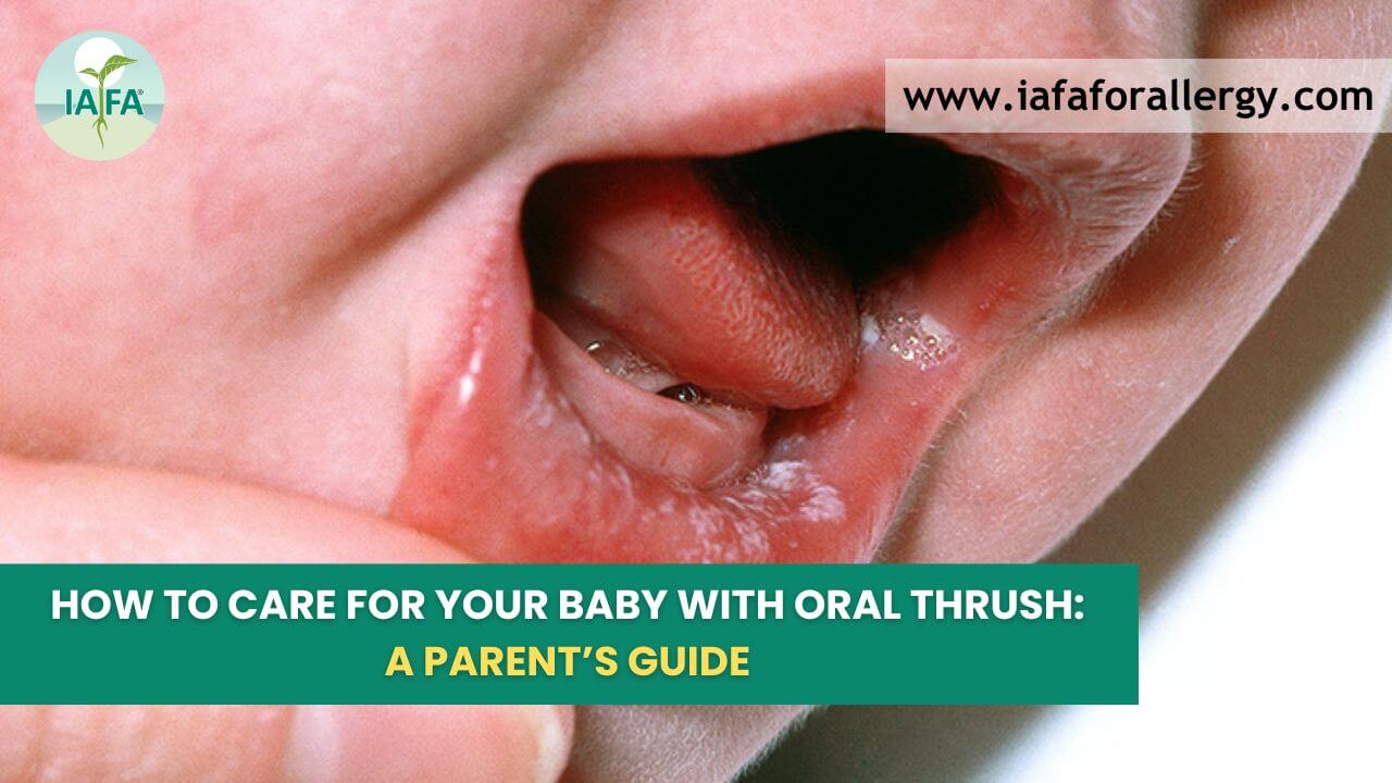 How to Care for Your Baby with Oral Thrush A Parent s Guide