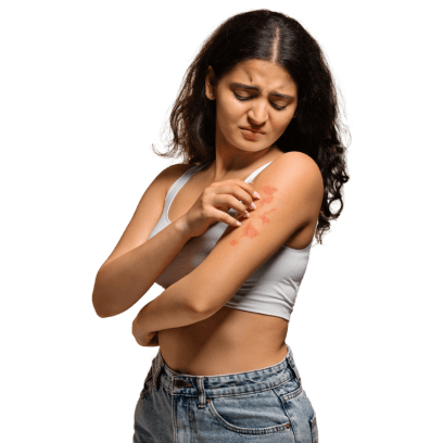 Dermatographia Ayurvedic Treatment - Causes, Symptoms and More