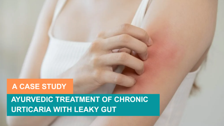 Ayurvedic Treatment for Urticaria - Causes, Symptoms and More