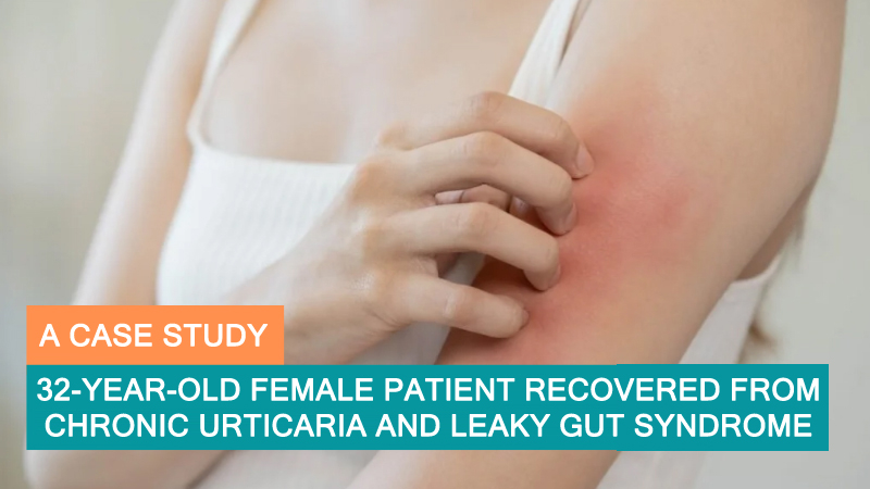 32-Year-Old Female Patient Recovered from Chronic Urticaria and Leaky Gut Syndrome – A Case Study