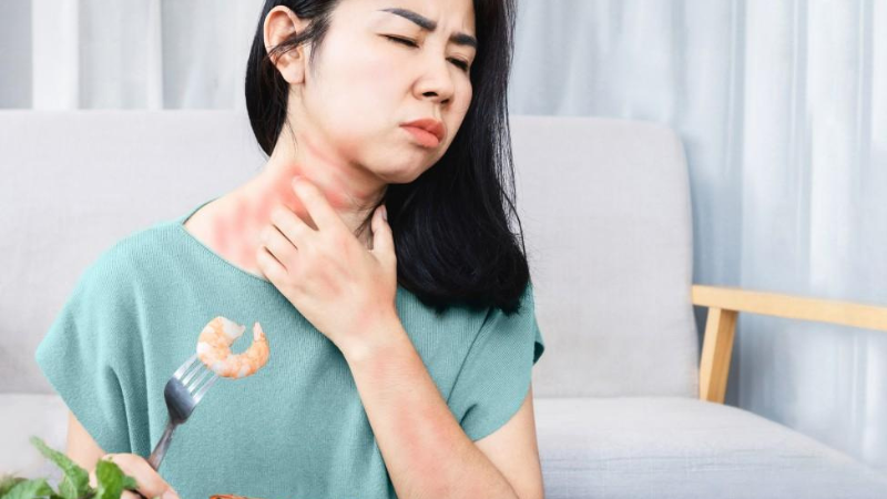 Best Diet Plan for Urticaria: Ayurvedic & Modern Nutrition Guide