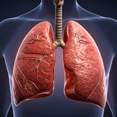 Ayurvedic Treatment for Lung Cancer